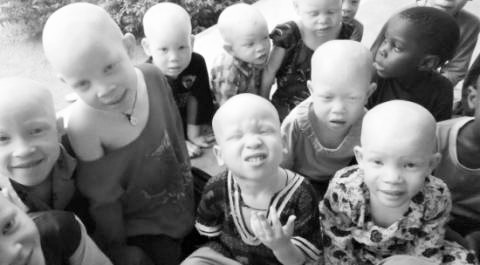 Albinos (2)