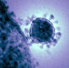 Qu’est-ce que les coronavirus font à notre corps