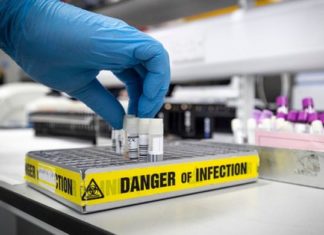 Sénégal : 4 021 cas de coronavirus enregistrés, 49 090 tests réalisés avec un taux de létalité de 1,12%