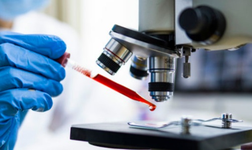 Scientist working with blood sample in laboratory