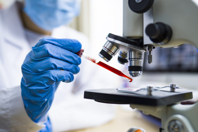 Scientist working with blood sample in laboratory