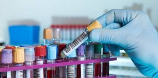 Covid-19 au Sénégal : 132 nouvelles contaminations, 4 décès, 34 patients en réanimation