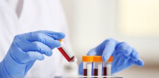 Covid-19 au Sénégal: 26 tests positifs, 0 décès, 32 patients en réanimation