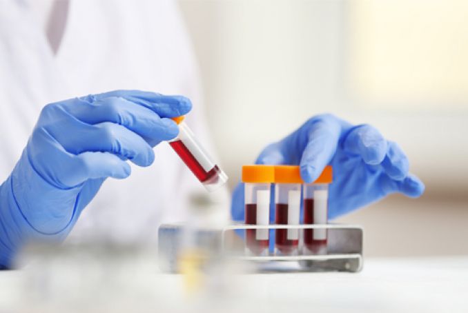 UNE_test-serologique