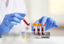 Covid-19: Le monde entre dans une période difficile, selon l’OMS