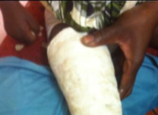 Amadou Barry fracture le genou de son employé, à Goundo Global Service