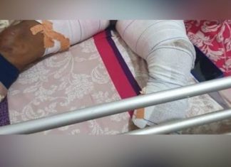 Yaoundé : elle ébouillante le sexe de son mari