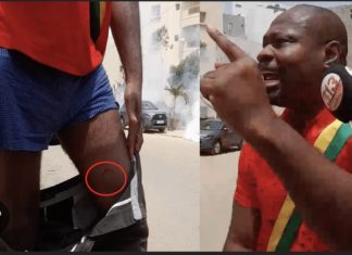 POLITIQUE : Venu soutenir Sonko placé en résidence surveillée, le député Guy Marius Sagna reçoit un projectile de la police