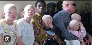 PRÉSIDENTIELLE 2024 : Les albinos craignent pour leur sécurité