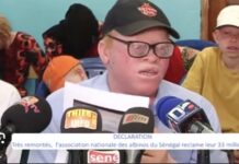 ASSOCIATION NATIONALE DES ALBINOS DU SÉNÉGAL : Le Président détourne plus de 30 millions F CFA