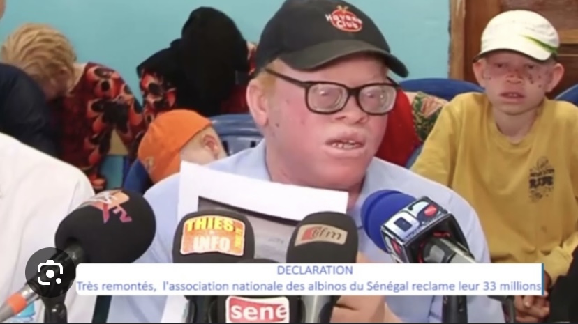ASSOCIATION NATIONALE DES ALBINOS DU SÉNÉGAL : Le Président détourne plus de 30 millions F CFA
